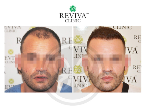 Slider image (10) Reviva Clinic